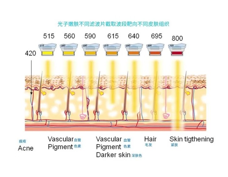 五大光子嫩膚技術(shù)（IPL、DPL、OPT、APT、BBL）及濾光片區別