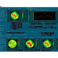 光學(xué)鏡片面形解析--從設計形狀到精度參數PV與RMS